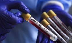 Rum makamlar Ebola’ya karşı uyarı durumunda